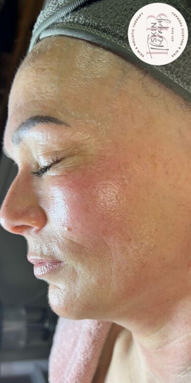 March DB Skin Therapy Hydro ageing skin face after