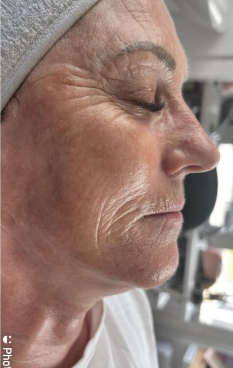 May Aphros Beauty Hydro renewing ageing skin face after