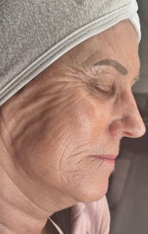 May Aphros Beauty Hydro renewing ageing skin face before