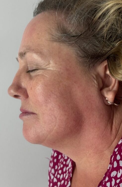November The Beauty Edit Collagen Lift Ageing Skin fine lines and wrinkles rejuvenation after