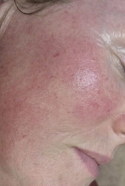 October Hidden Beauty Arva Collagen Lift youthful skin boost radio frequency after