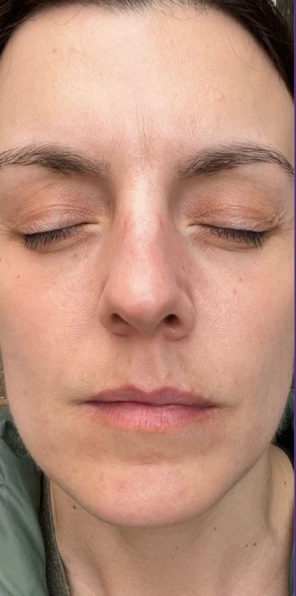 perrys beauty after feb 24