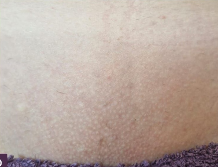 perrys beauty after august 25