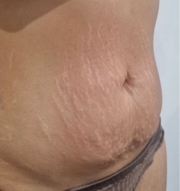 perrys beauty after july 25