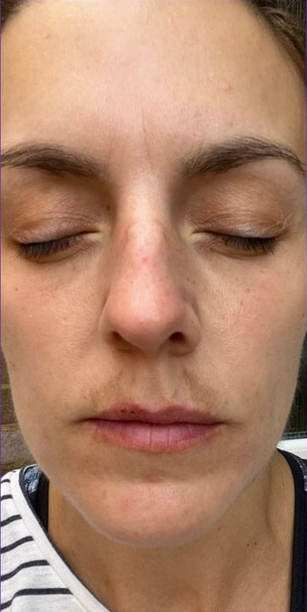 perrys beauty before feb 2024