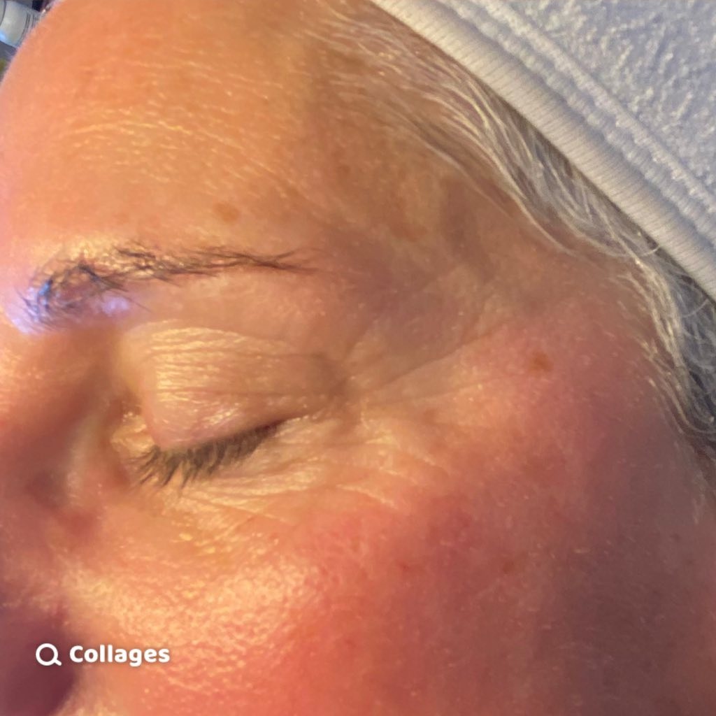 JANUARY 2026 Glow With Anna Jane Collagen Lift ageing skin face before and after glowing skin after