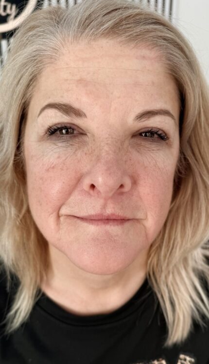 January 2026 T M Aesthetics and Beauty 2 Paula Collagen Lift ageing skin transformation radio-frequency glowing skin afte