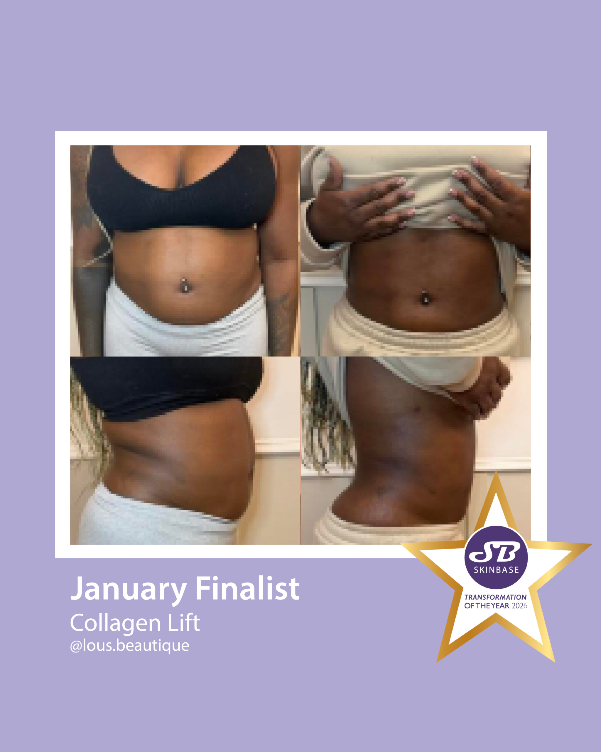 January Finalists Lou's Beautique Collagen Lift