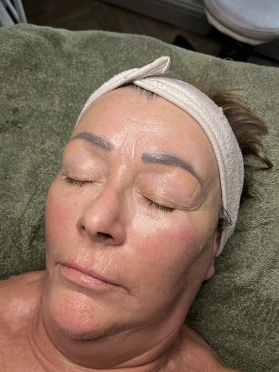 February 2026 NB Nails Holistics Beauty Collagen Lift Facial Transformation Glowing Skin After