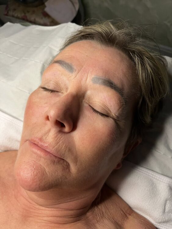 February 2026 NB Nails Holistics Beauty Collagen Lift Facial Transformation Glowing Skin Before