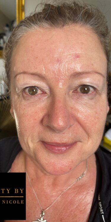 March 2026 Beauty by Holly Nicole Collagen Lift Facial for Rejuvenating Ageing Skin After