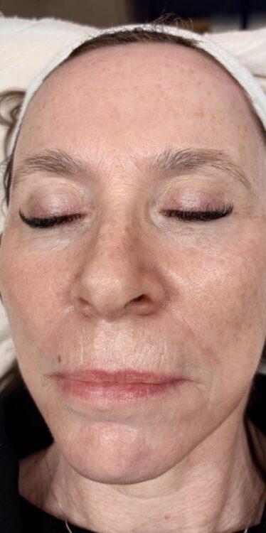 March 2026 Clarissa's beauty Boutique Microdermabrasion for ageing skin results after