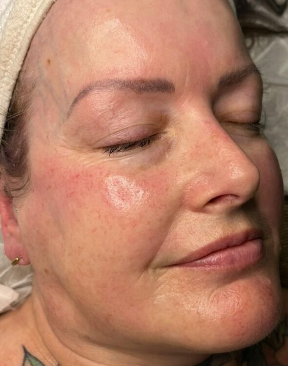 March 2026 NB Nails Holistics Beauty Microdermabrasion Hydro combination for glowing skin results after