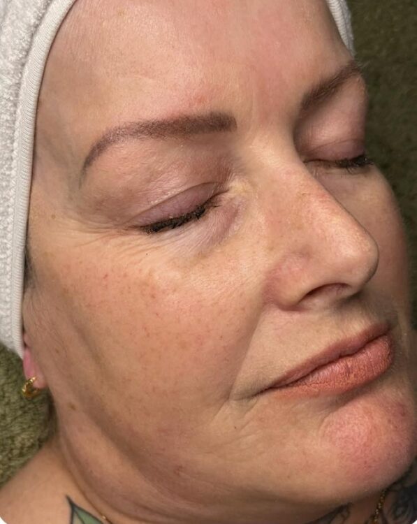 March 2026 NB Nails Holistics Beauty Microdermabrasion Hydro combination for glowing skin results before