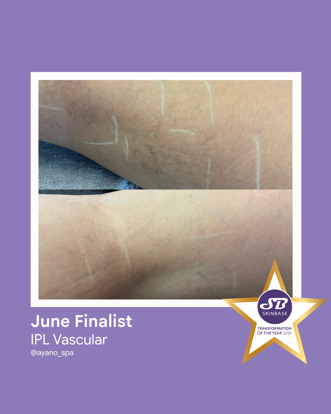 FINALIST June 2026 Ayano Spa IPL