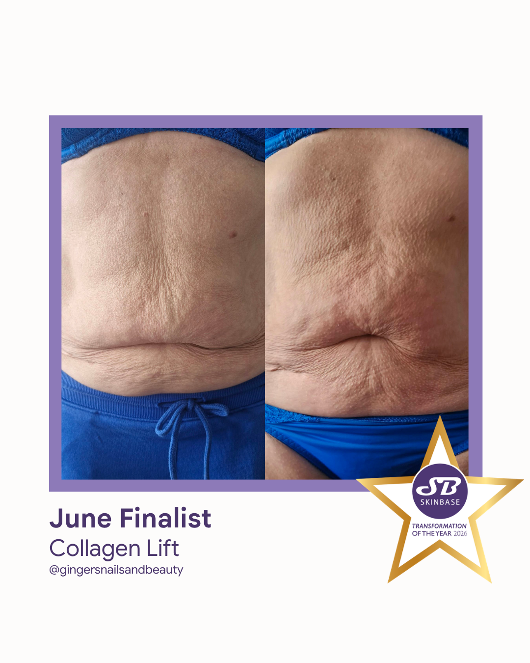 FINALIST June 2026 Gingers Nails & Beauty Collagen Lift
