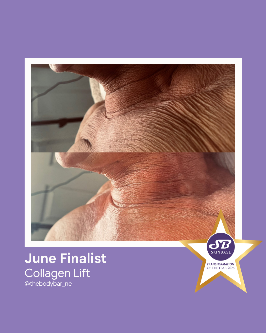 FINALIST June 2026 The Body Bar Collagen Lift
